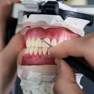 A denture being finished by a dental lab tech