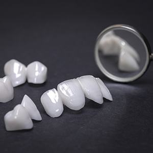 Dental bridges and crowns