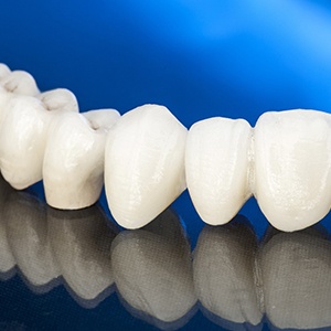 All-ceramic bridge and crowns