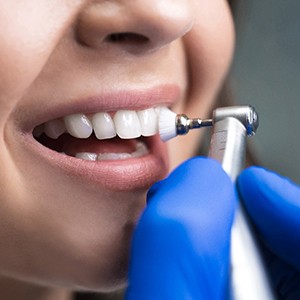 A dentist cleaning a patient’s teeth