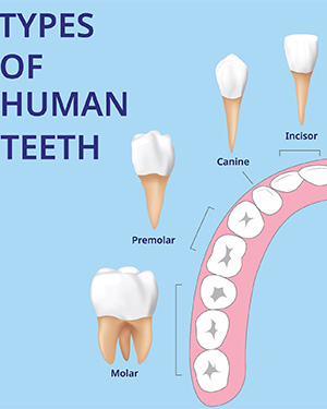 location of teeth types for cost of tooth extraction in Haverhill 