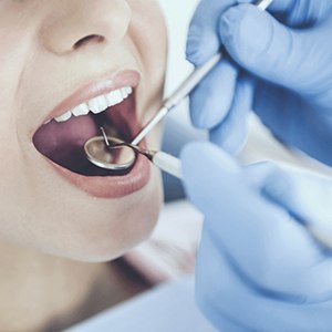 Patient getting dental crowns in Haverhill
