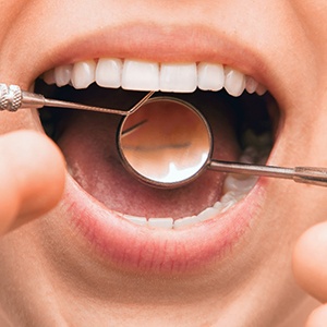 Woman having a semi-annual dental appointment