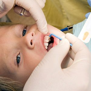 Child receiving fluoride treatment