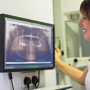 Panoramic dental x-rays