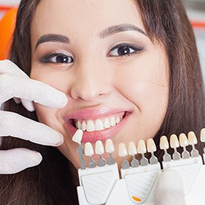 Woman's smile compared with porcelain veneer color chart