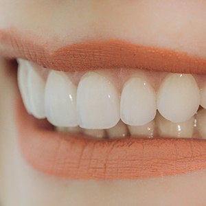 Closeup of woman with porcelain veneers in Haverhill