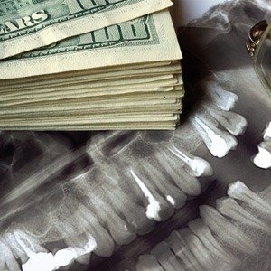 Stack of money lying on a dental x-ray