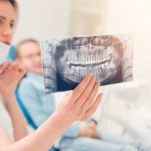 an X-ray of a patient’s mouth before wisdom tooth extractions